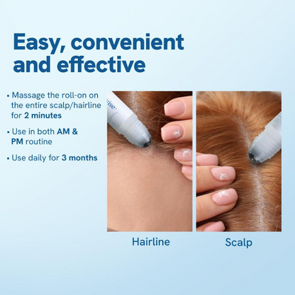 Almeria™ Advanced Hair Growth Roll-On Serum